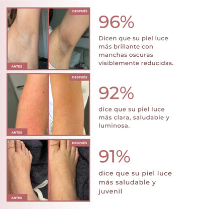 Spray exfoliante corporal - Kójico + Cúrcuma