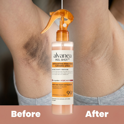 Body Peel Spray - Kojic + Turmeric